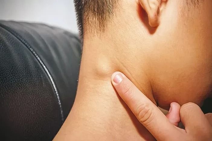 Kenali Gejala Awal Kanker Getah Bening Sebelum Terlambat