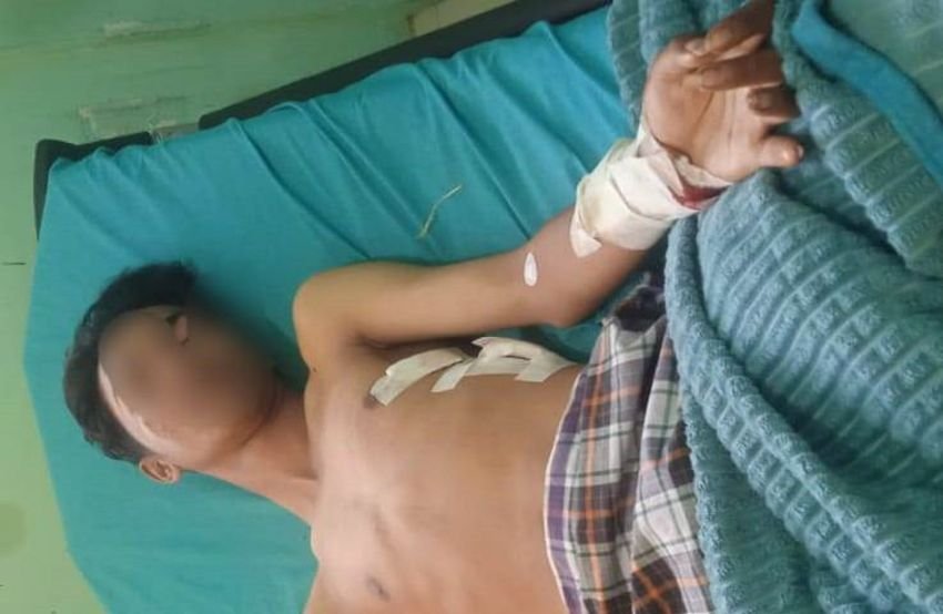 Pemuda Dibacok di Jalan Bandara Kualanamu, Sepeda Motor dan HP Raib Dirampok
