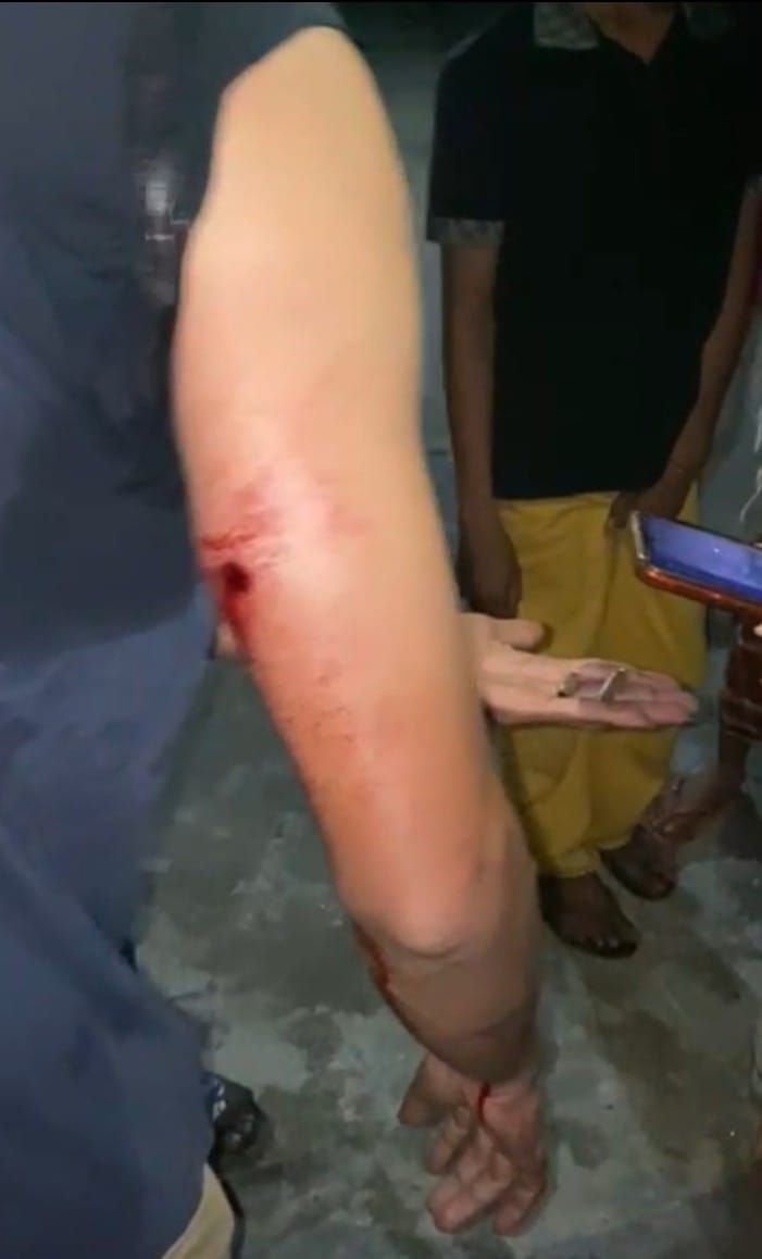 Tawuran di Medan Labuhan, Polisi Dilempar Batu, 2 Warga Luka Tembak